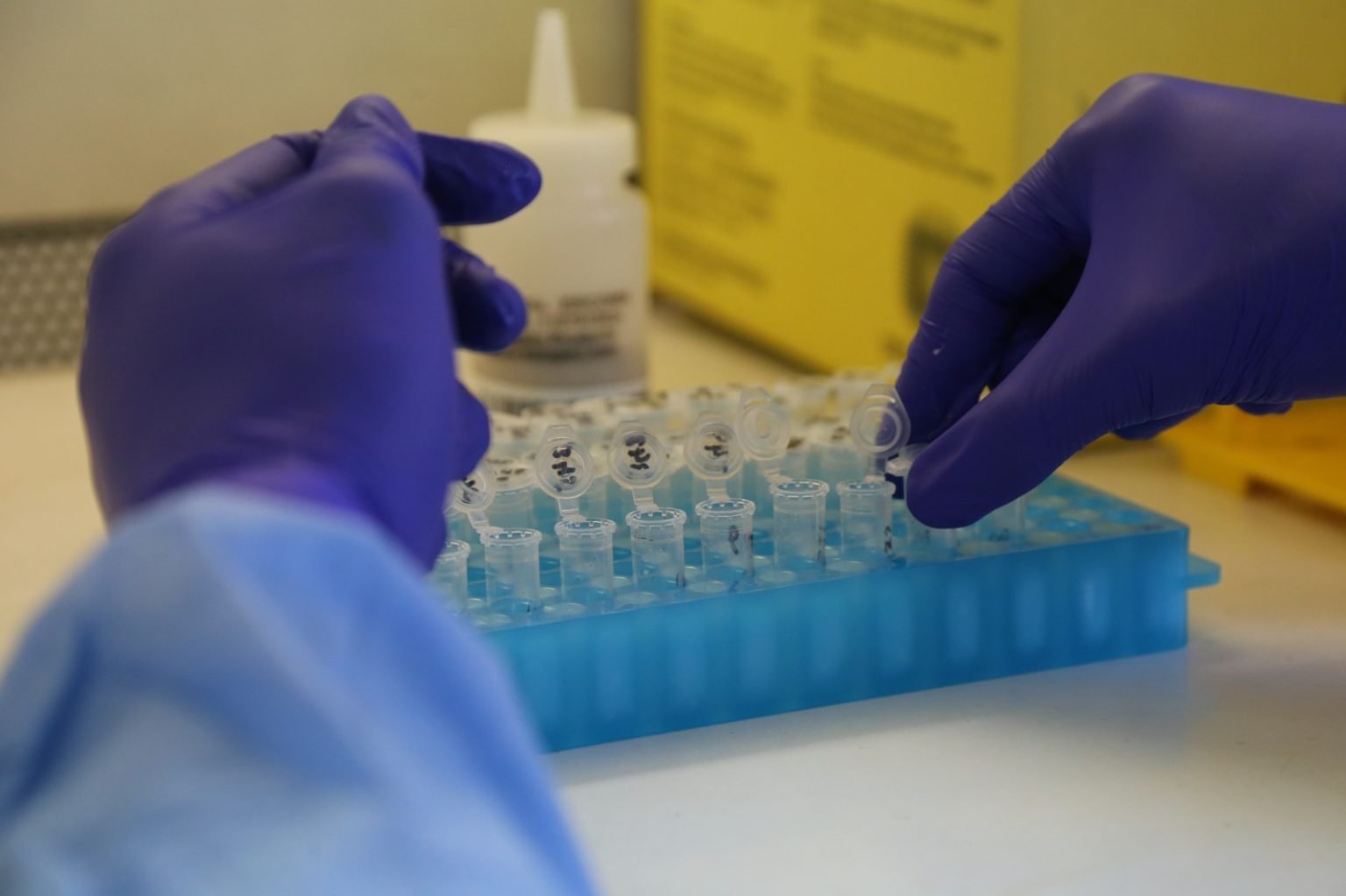 Niterói não tem caso confirmado de Mpox, esclarece Secretaria de Saúde